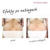 Endermologia Primelle - obrazek 11