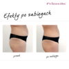 Endermologia Primelle - obrazek 12