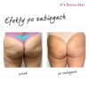 Endermologia Primelle - obrazek 9