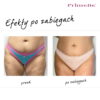 Endermologia Primelle - obrazek 7