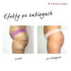 Endermologia Primelle - obrazek 21