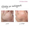 Endermologia Primelle - obrazek 4