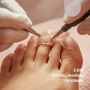 Praca ze zmianami skórnymi stóp: odciski i modzele